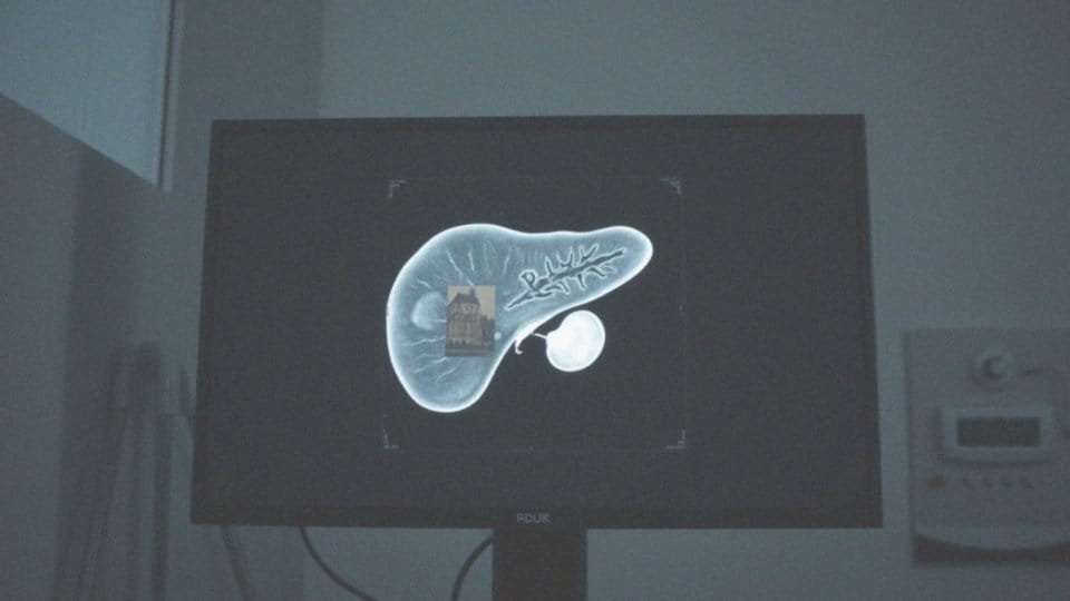 Hipowaskularny – co to znaczy i jakie ma znaczenie w diagnostyce?