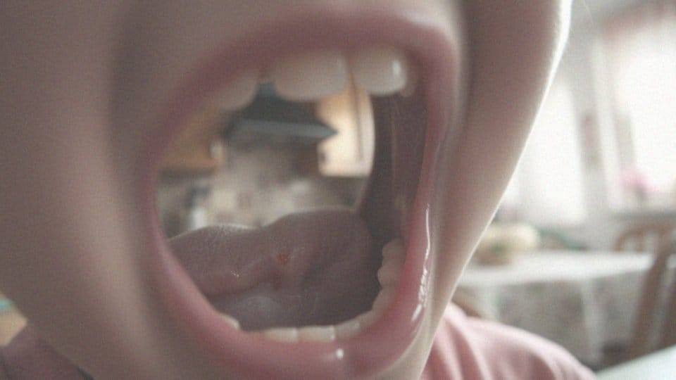 Kiedy wypadają mleczaki? Kluczowe informacje o zębach mlecznych